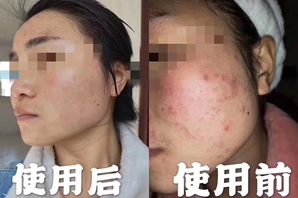 精油能喝嗎？不是所有精油都能喝-歐泉生化